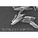 0303_bakterije_oblika_bacili.jpg<>Bakterija Mycobacterium tuberculosis je povzročitelj pljučne bolezni tuberkuloze (elektronski mikroskop; povečava: 15.000-krat).