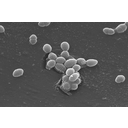 0303_bakterije_oblika_koki.png<>Kok Enterococcus faecalis (elektronski mikroskop; povečava: 15.000-krat).