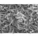 0303_bakterije_oblika_vibriji.jpg<>Bakterije Vibrio cholera povzročajo črevesno bolezen kolero (elektronski mikroskop; povečava: 15.000-krat).